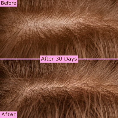 Cionta Red & Blue Light Scalp Therapy Brush